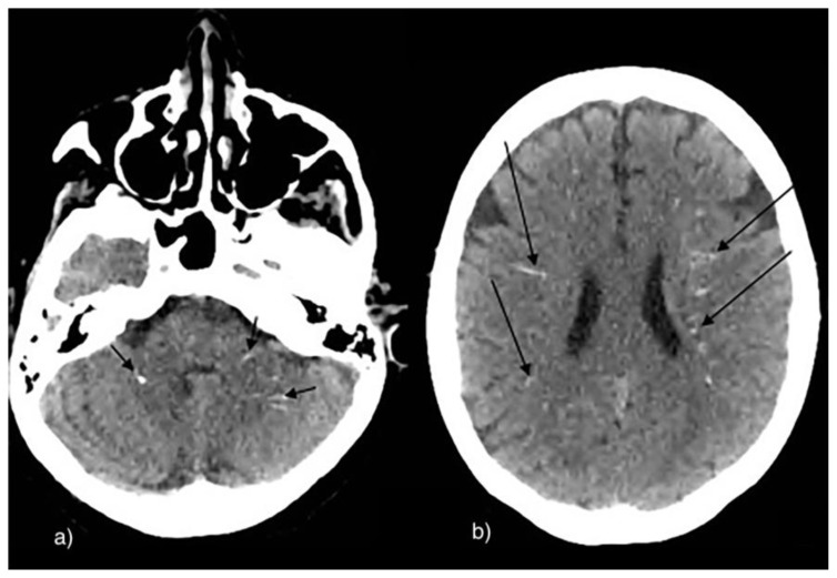 Figure 13