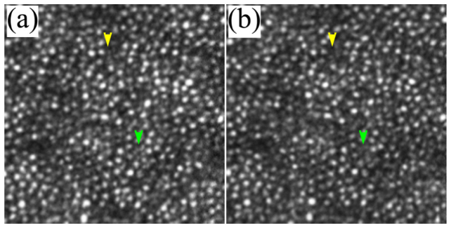 Fig. 11