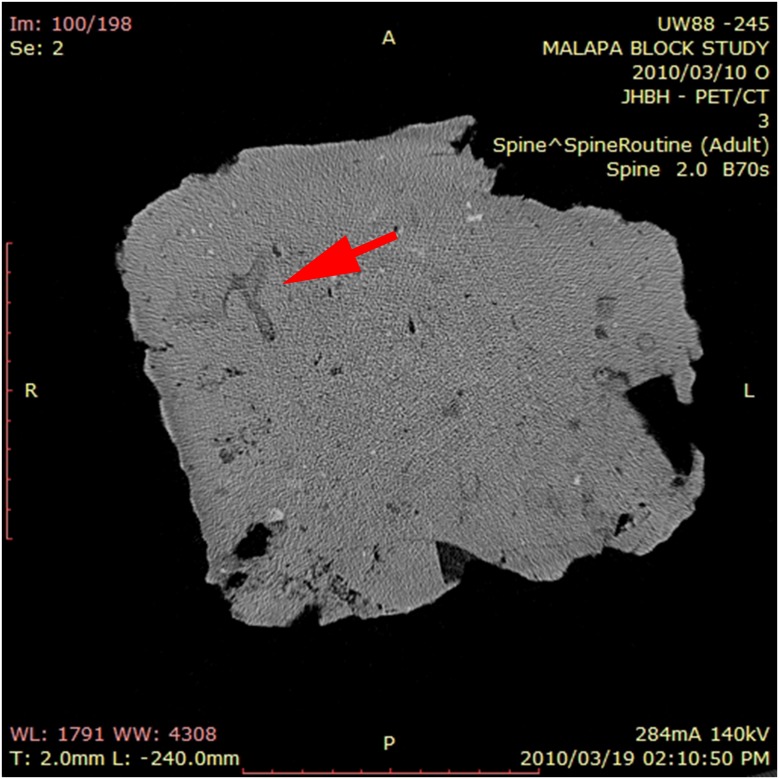 Fig 3