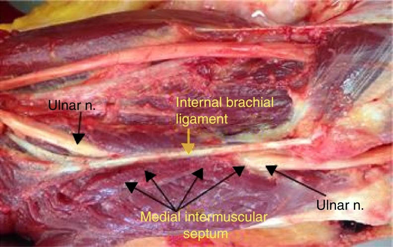 Fig. 9