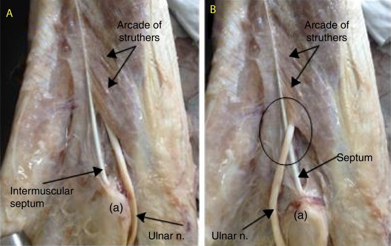 Fig. 10