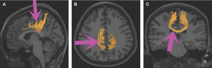 FIGURE 16.