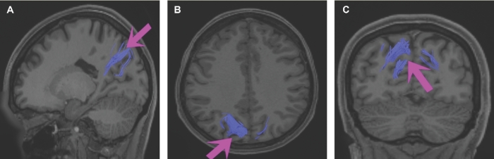 FIGURE 30.