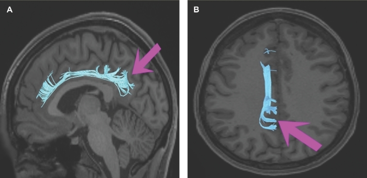 FIGURE 26.