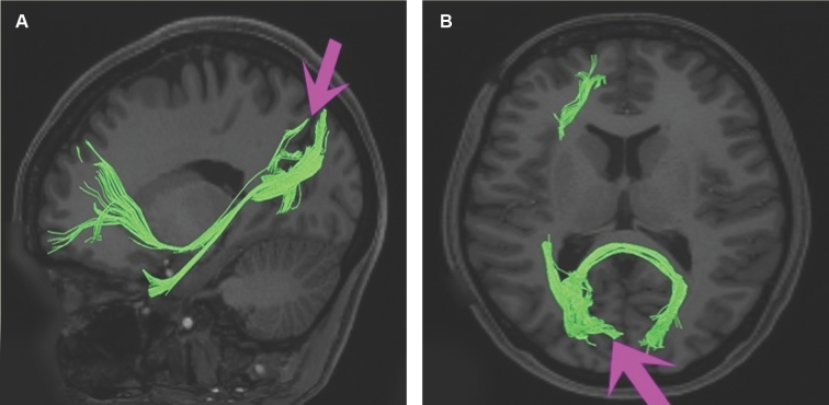 FIGURE 34.