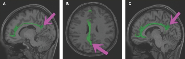 FIGURE 14.