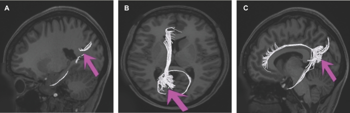 FIGURE 32.