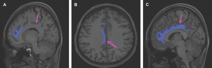 FIGURE 18.