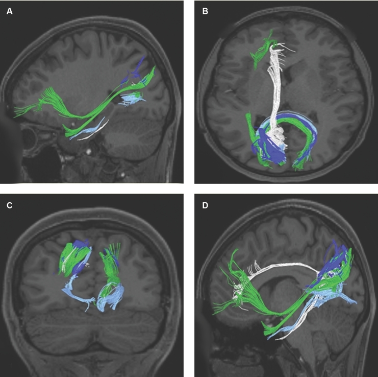 FIGURE 28.