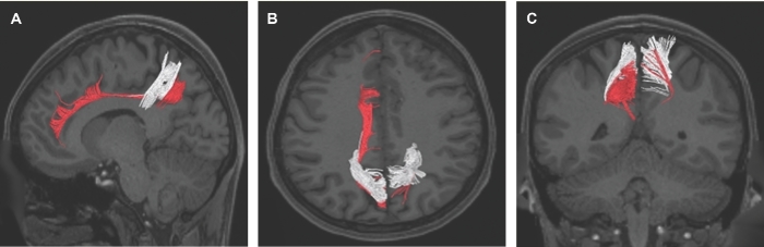 FIGURE 22.