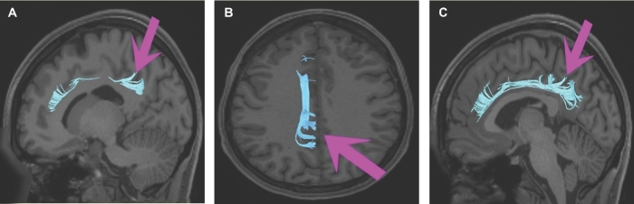 FIGURE 12.