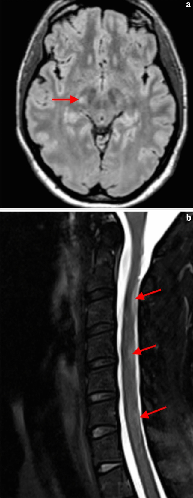 Fig. 2