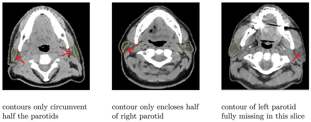 Fig 9.