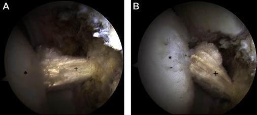 Fig 4