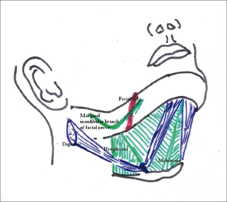 Submental intubation: A journey over the last 25 years - PMC