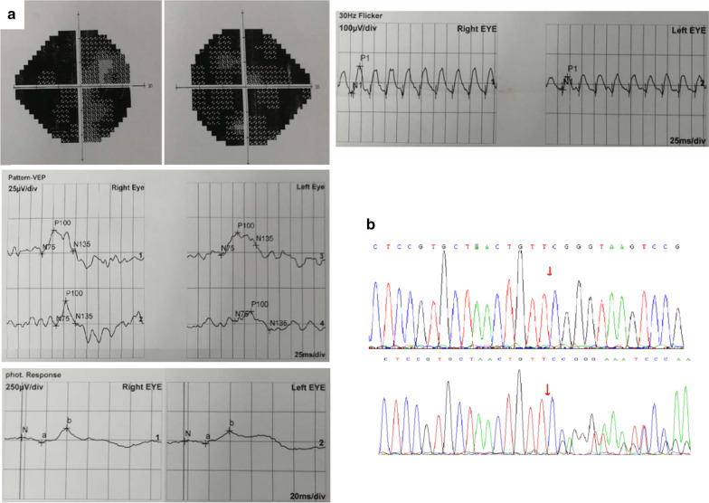 Fig. 3