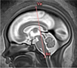 graphic file with name nihpp-2024.08.13.24311408v1-t0026.jpg