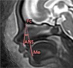 graphic file with name nihpp-2024.08.13.24311408v1-t0014.jpg