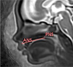 graphic file with name nihpp-2024.08.13.24311408v1-t0015.jpg