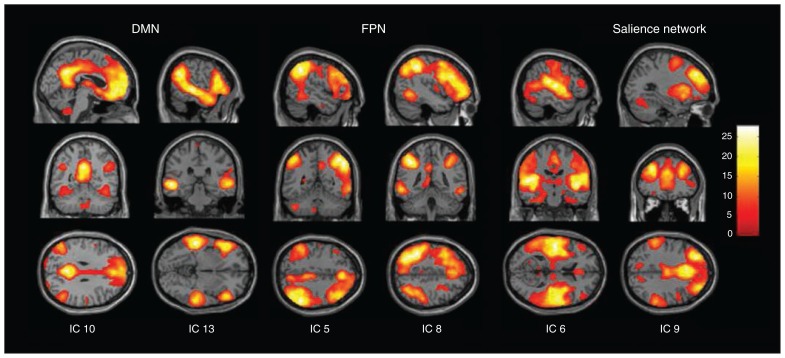 Fig. 1