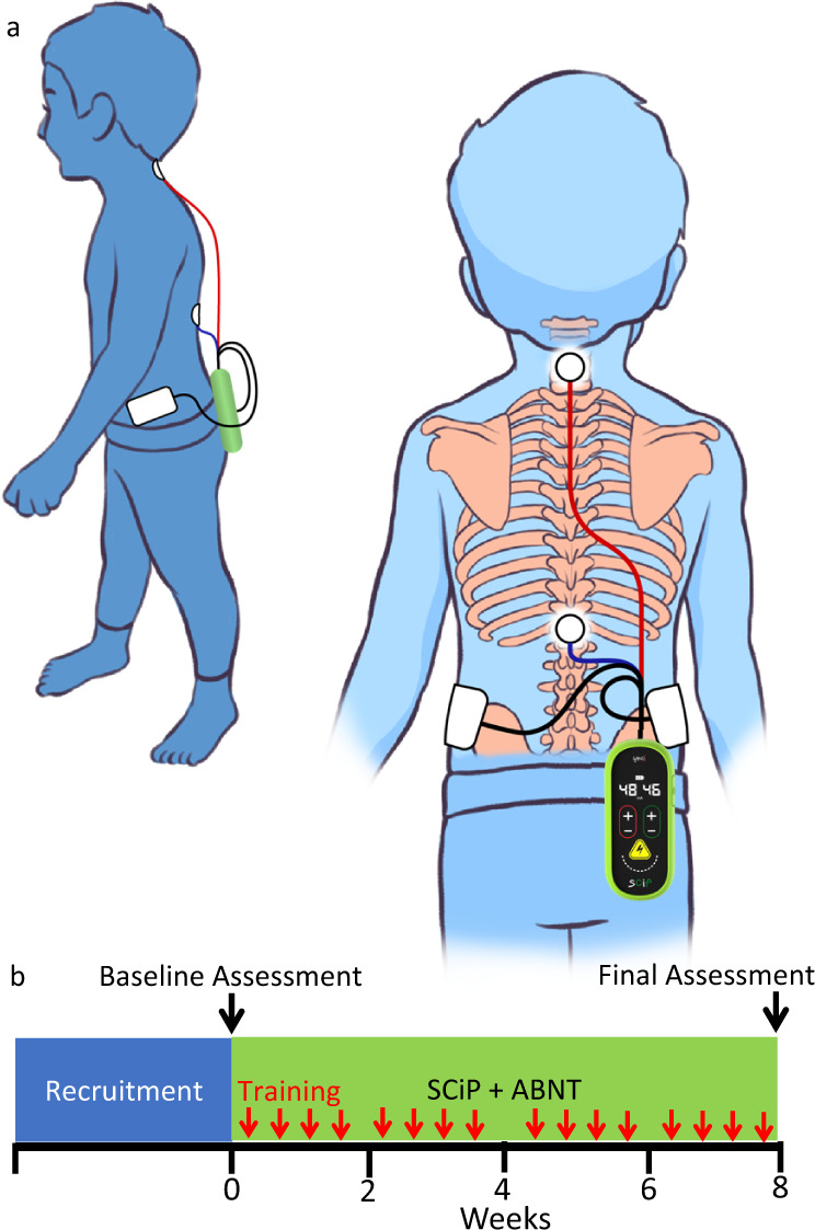 Fig. 1