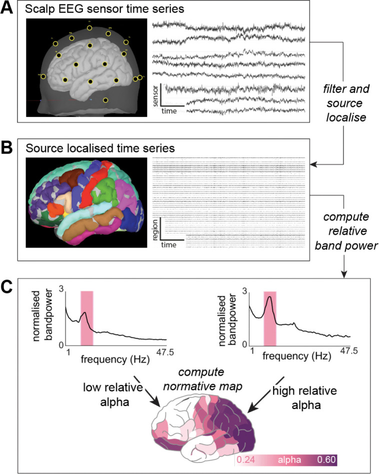 Normative brain mapping using scalp EEG and potential clinical ...