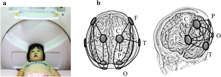 Fig. 1