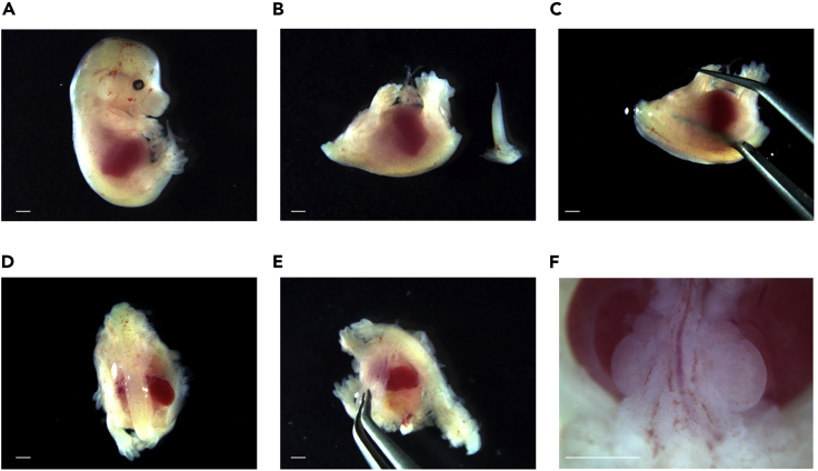 Figure 3