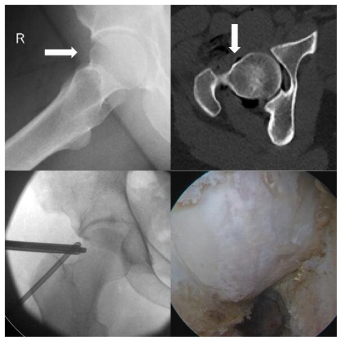 Figure 1