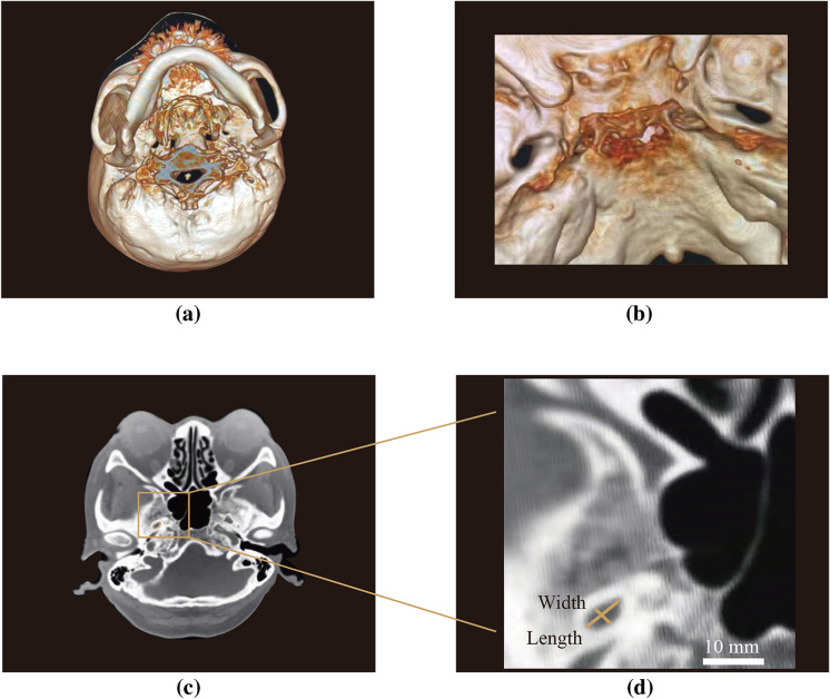 Fig. 2