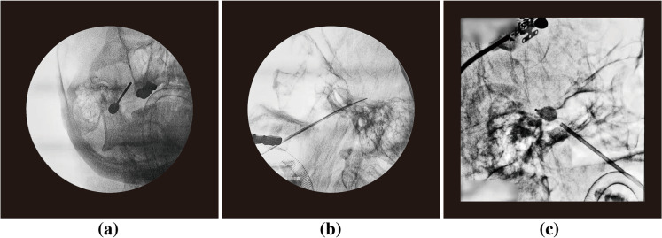 Fig. 3