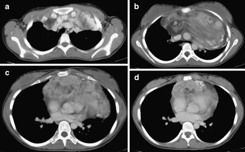 Fig. 1