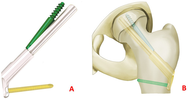 Fig. 1