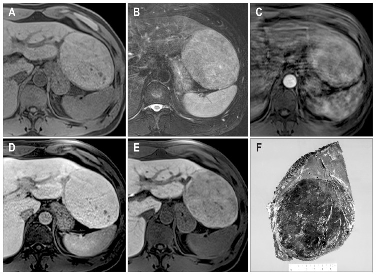 Fig. 5