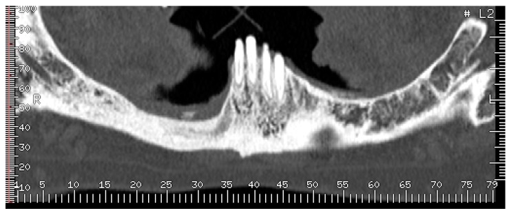 Figure 13