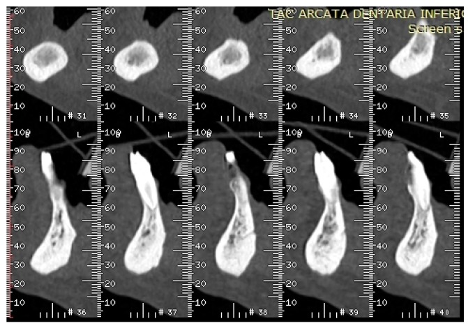 Figure 12