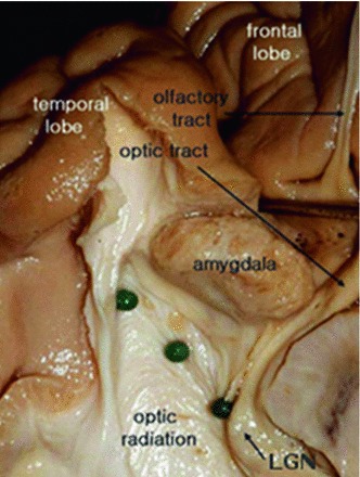 Fig. 13