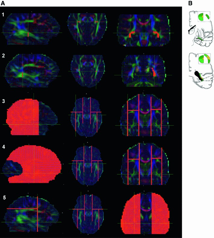 Fig. 3