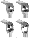 Fig. 1A–D