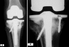Fig. 5A–B
