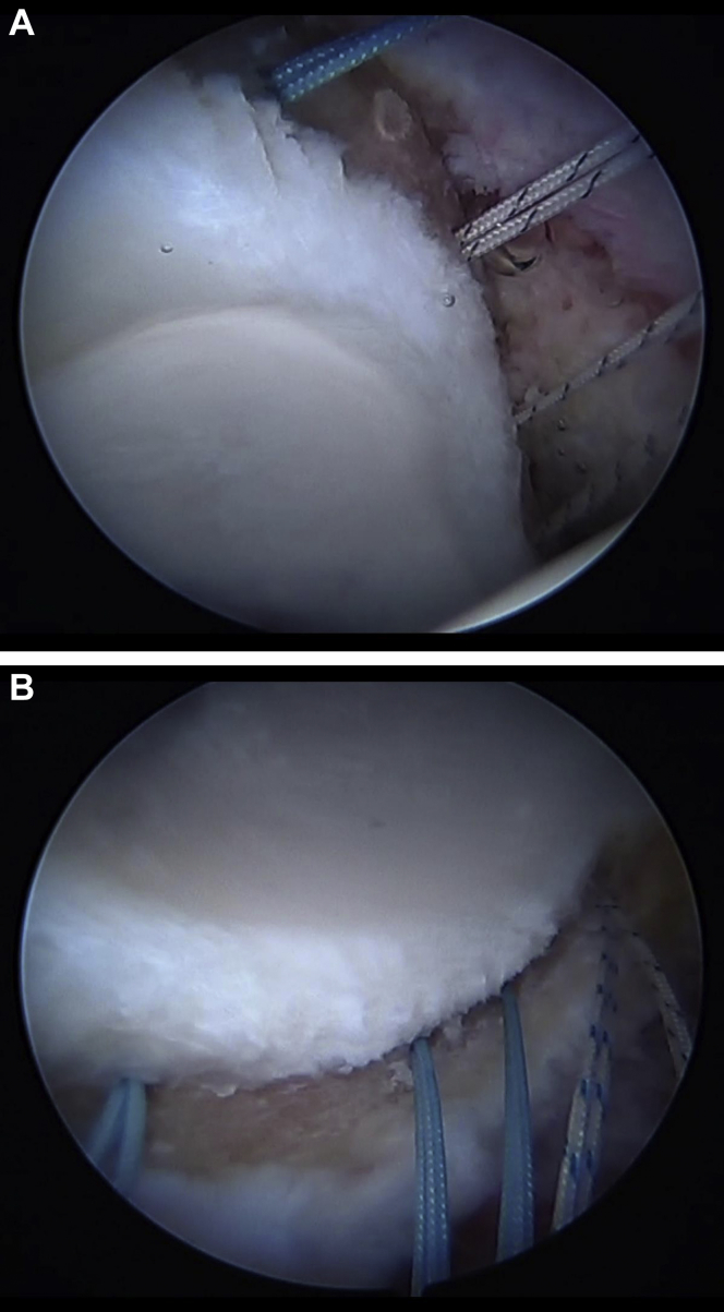 Fig 6