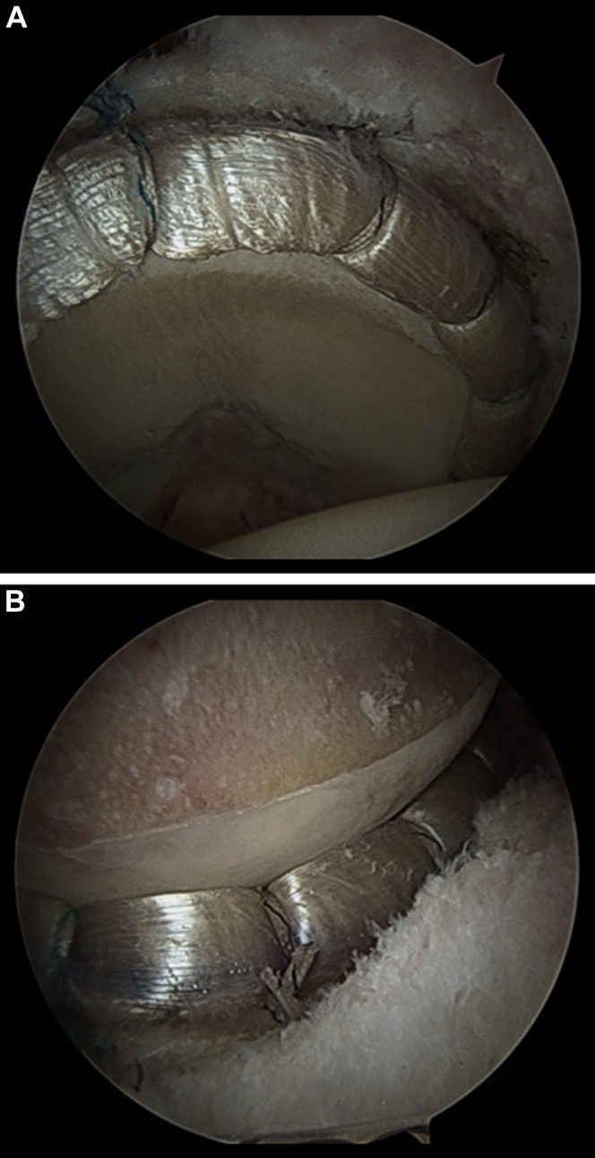 Fig 22