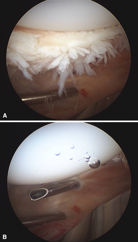 Fig. 1A–B