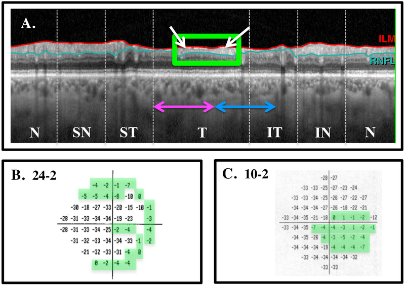 Figure 4: