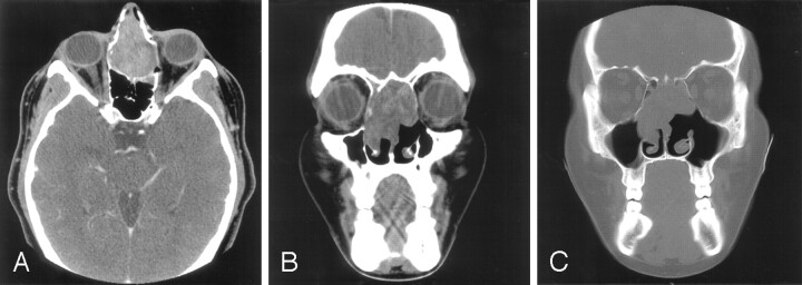 Fig 1.