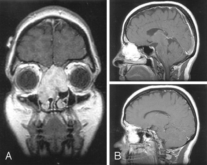 Fig 2.