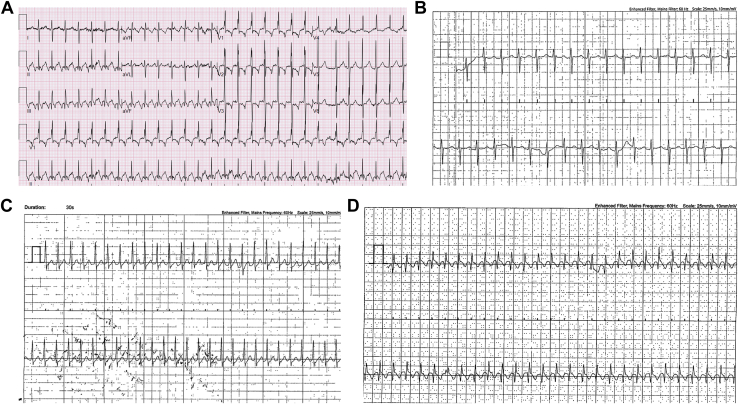 Figure 1