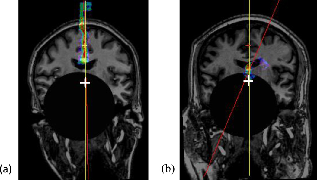 Fig. 14