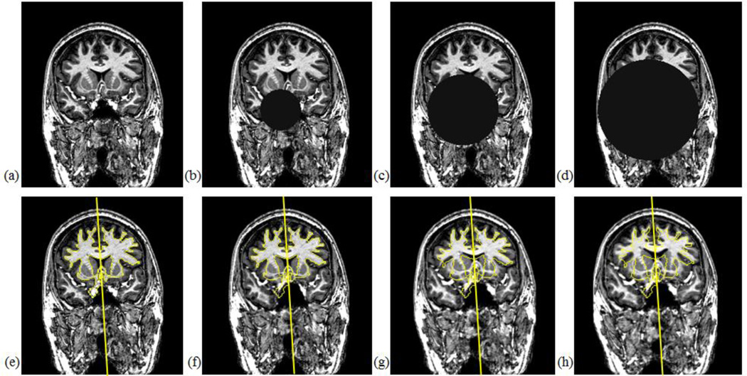 Fig. 12