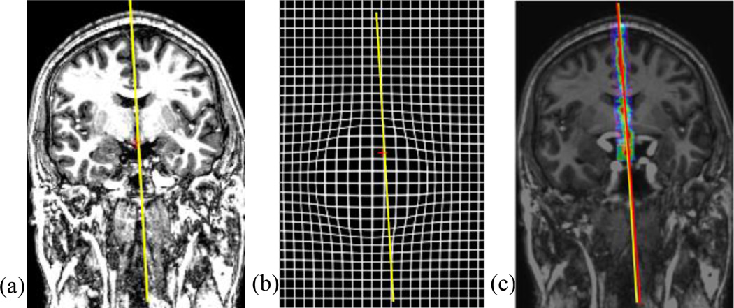 Fig. 16